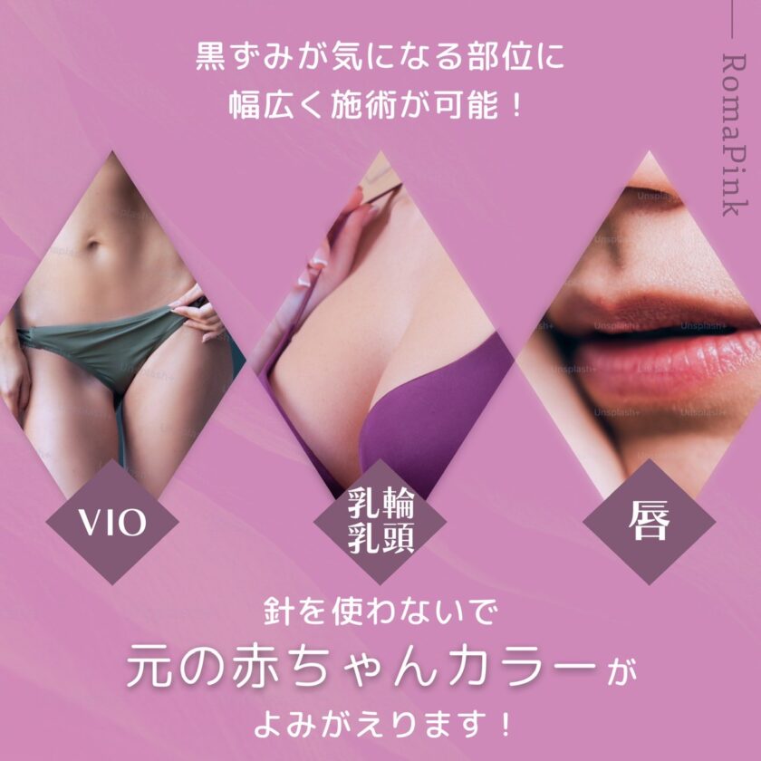ローマピンク画像